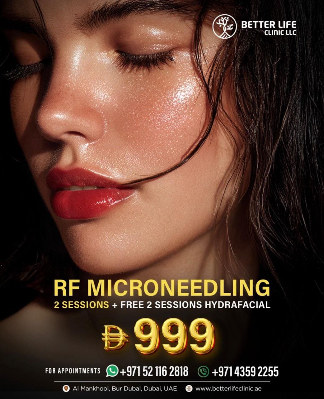 RF Microneedling in Dubai  Acne Scar Removal & Skin Tightening Package