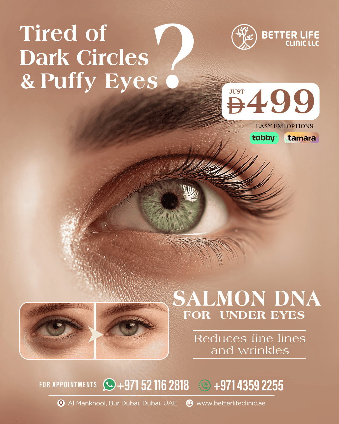 Under Eye Dark Circles Treatment – Affordable Eye Rejuvenation Offers