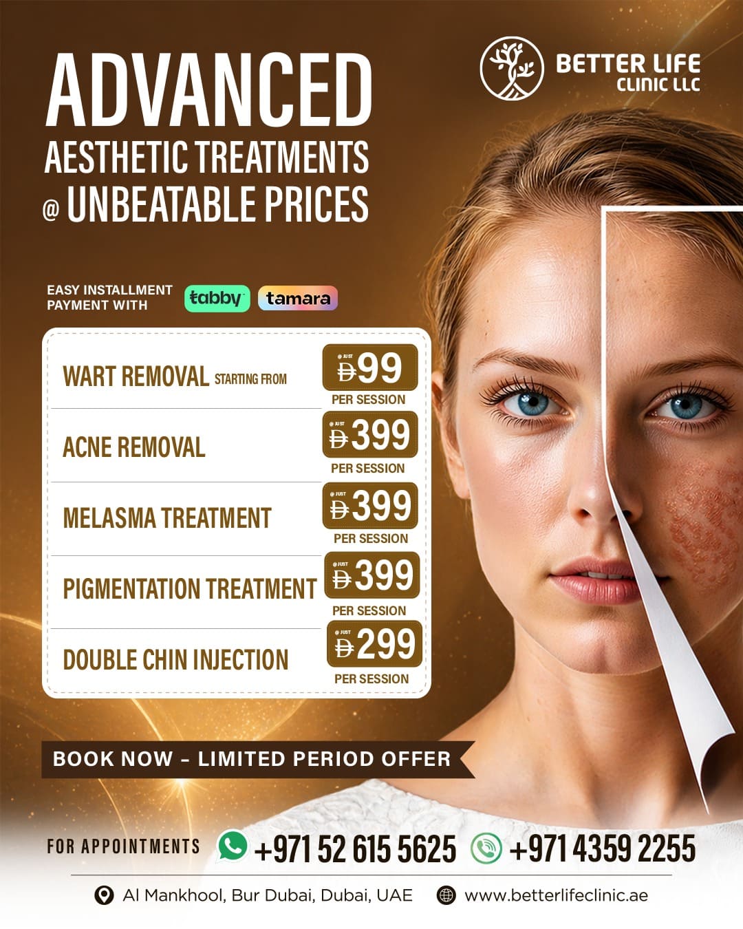 Best Aesthetic treatment offer in Burdubai
