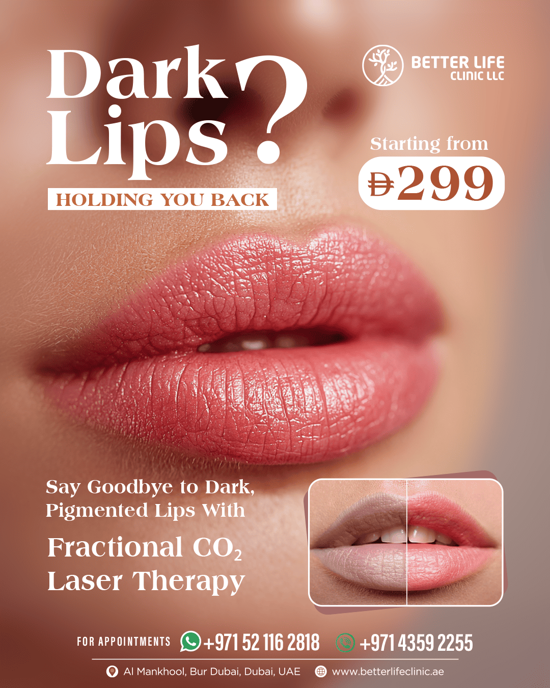 Dark Lips Treatment – Lip Pigmentation Removal Offers