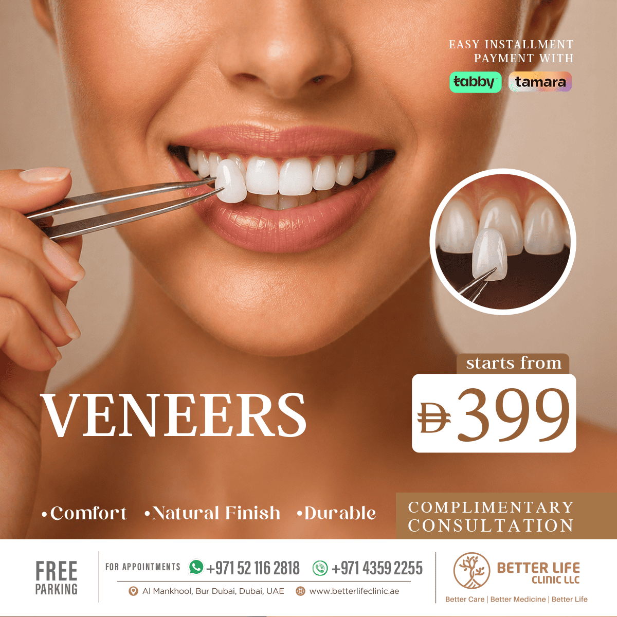 Dental Veneers in Dubai Smile Makeover & Porcelain Veneers Offer