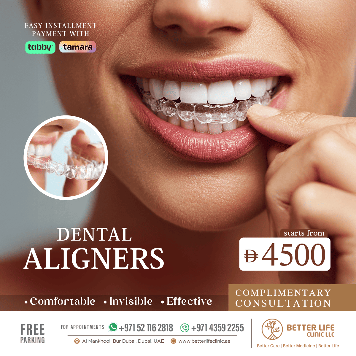 Invisalign Treatment in Bur Dubai Invisible Braces for Adults