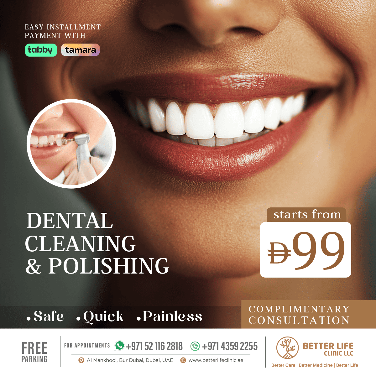 Teeth Cleaning & Polishing in Dubai Professional Dental Hygiene Offer
