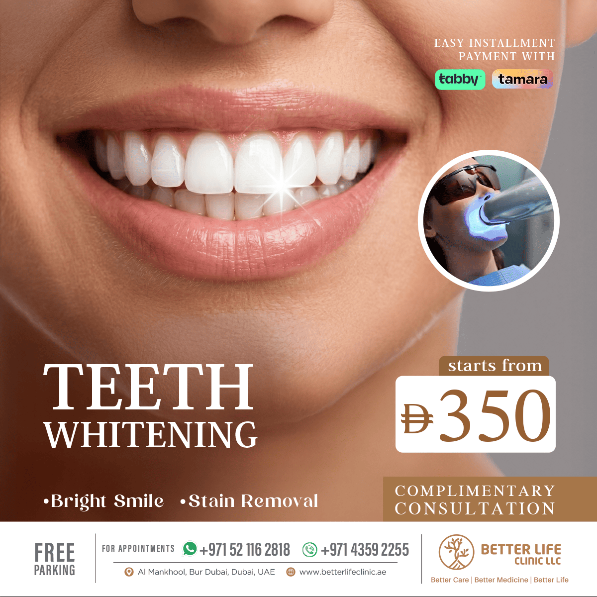 Teeth Whitening in Dubai Instant Bright Smile Treatment Offer