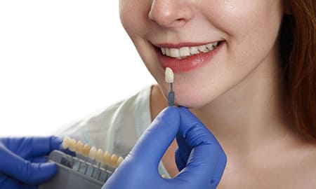 Dental Crowns & Caps